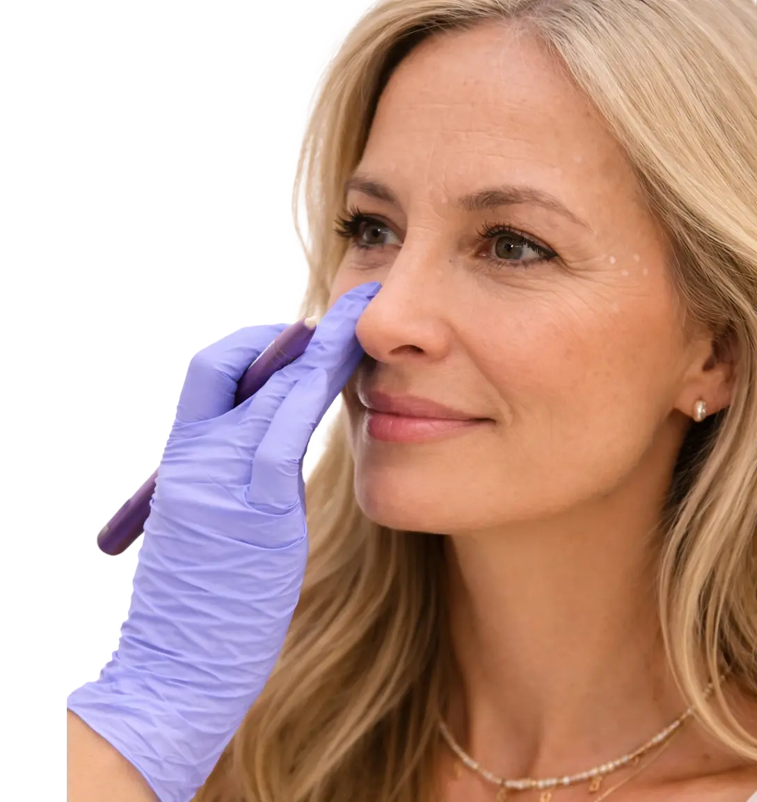 Tratamientos de medicina estética